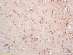 SOAT2 Antibody in Immunohistochemistry (Paraffin) (IHC (P))