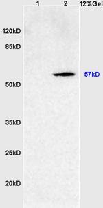 SOAT2 Antibody in Western Blot (WB)
