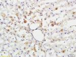ABHD5 Antibody in Immunohistochemistry (Paraffin) (IHC (P))
