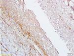 AGPAT4 Antibody in Immunohistochemistry (Paraffin) (IHC (P))