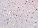 CROT Antibody in Immunohistochemistry (Paraffin) (IHC (P))
