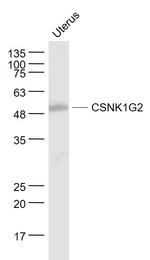 CSNK1G2 Antibody in Western Blot (WB)