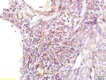 GNPAT Antibody in Immunohistochemistry (Paraffin) (IHC (P))