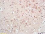 GPAM Antibody in Immunohistochemistry (Paraffin) (IHC (P))