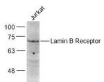 Lamin B Receptor Antibody in Western Blot (WB)