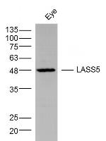 LASS5 Antibody in Western Blot (WB)