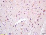KAT2B Antibody in Immunohistochemistry (Paraffin) (IHC (P))