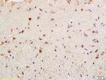 BAG2 Antibody in Immunohistochemistry (Paraffin) (IHC (P))