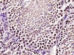 CREM Antibody in Immunohistochemistry (Paraffin) (IHC (P))