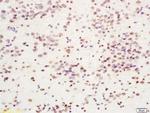 Cdc7 Antibody in Immunohistochemistry (Paraffin) (IHC (P))