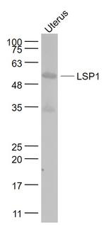 LSP1 Antibody in Western Blot (WB)