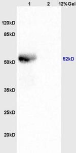 Phospho-LSP1 (Ser204) Antibody in Western Blot (WB)