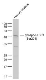 Phospho-LSP1 (Ser204) Antibody in Western Blot (WB)