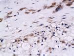 Cystatin B Antibody in Immunohistochemistry (Paraffin) (IHC (P))