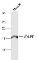 Fast skeletal Myosin Antibody in Western Blot (WB)