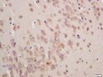 GSTA3 Antibody in Immunohistochemistry (Paraffin) (IHC (P))