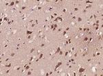 Phospho-APBB1 (Ser175) Antibody in Immunohistochemistry (Paraffin) (IHC (P))