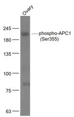 Phospho-APC1 (Ser355) Antibody in Western Blot (WB)