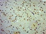 Phospho-APC1 (Ser377) Antibody in Immunohistochemistry (Paraffin) (IHC (P))