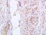 Phospho-GADD153 (Ser30) Antibody in Immunohistochemistry (Paraffin) (IHC (P))