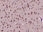 Phospho-AKT1 (Ser129) Antibody in Immunohistochemistry (Paraffin) (IHC (P))