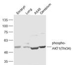 Phospho-AKT1 (Thr34) Antibody in Western Blot (WB)
