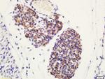 Phospho-ATG4D (Ser467) Antibody in Immunohistochemistry (Paraffin) (IHC (P))