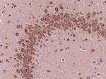 Phospho-Bad (Ser118) Antibody in Immunohistochemistry (Paraffin) (IHC (P))