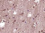 Phospho-Bad (Ser118) Antibody in Immunohistochemistry (Paraffin) (IHC (P))