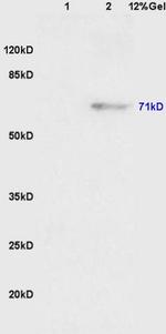 Phospho-Wee1 (Ser123) Antibody in Western Blot (WB)