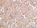 Phospho-BRCA1 (Ser1189) Antibody in Immunohistochemistry (Paraffin) (IHC (P))