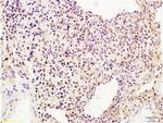 Phospho-BRIP1 (Ser990) Antibody in Immunohistochemistry (Paraffin) (IHC (P))