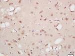 Phospho-B-Raf (Ser446) Antibody in Immunohistochemistry (Paraffin) (IHC (P))