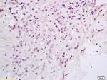 Phospho-Bcl-xL (Thr115) Antibody in Immunohistochemistry (Paraffin) (IHC (P))