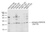 Phospho-CDKN1B  (Ser178) Antibody in Western Blot (WB)