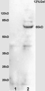 Phospho-Cdc25B (Ser323) Antibody in Western Blot (WB)