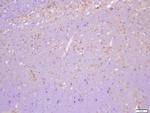 Phospho-Cofilin (Tyr140) Antibody in Immunohistochemistry (Paraffin) (IHC (P))