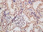 Phospho-CDKN1A (Ser130) Antibody in Immunohistochemistry (Paraffin) (IHC (P))