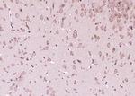 Phospho-CDKN1B (Thr198) Antibody in Immunohistochemistry (Paraffin) (IHC (P))