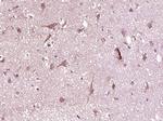 Phospho-CDK6 (Tyr24) Antibody in Immunohistochemistry (Paraffin) (IHC (P))