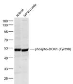 Phospho-DOK1 (Tyr398) Antibody in Western Blot (WB)