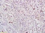 Phospho-DAXX (Ser495) Antibody in Immunohistochemistry (Paraffin) (IHC (P))