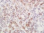 Phospho-DAXX (Ser517) Antibody in Immunohistochemistry (Paraffin) (IHC (P))