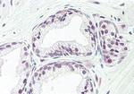 TAF1 Antibody in Immunohistochemistry (Paraffin) (IHC (P))