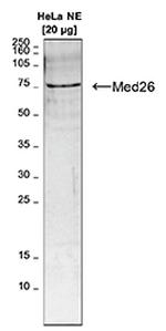 Med26 Antibody in Western Blot (WB)