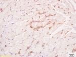 Phospho-FGFR1 (Tyr307) Antibody in Immunohistochemistry (Paraffin) (IHC (P))
