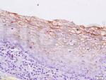 Cytokeratin 5 Antibody in Immunohistochemistry (Paraffin) (IHC (P))