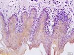 Cytokeratin 5 Antibody in Immunohistochemistry (Paraffin) (IHC (P))