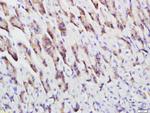 Cytokeratin 5 Antibody in Immunohistochemistry (Paraffin) (IHC (P))