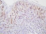 Cytokeratin 5 Antibody in Immunohistochemistry (Paraffin) (IHC (P))